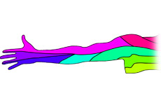 Arm Pain of Spinal Origin