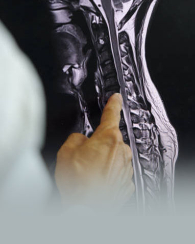 Augmented Reality in Spine Surgery